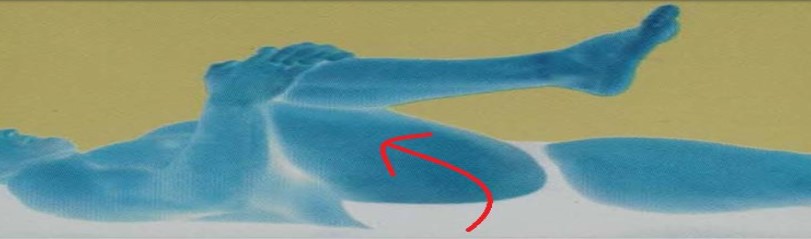 Exercise 12-Gluteal stretches.